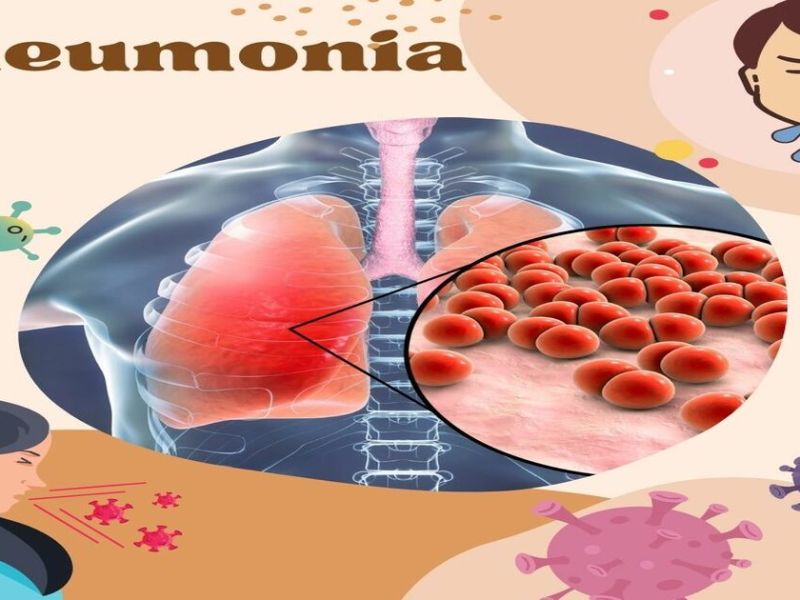 Why is the pneumonia-related mortality rate higher in the U.S?